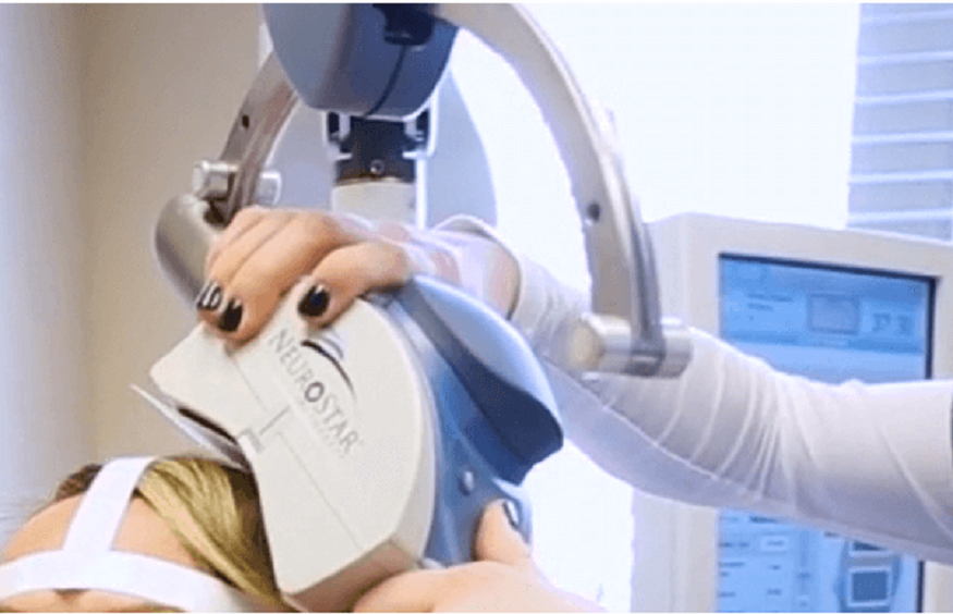 need to know about TMS Therapy